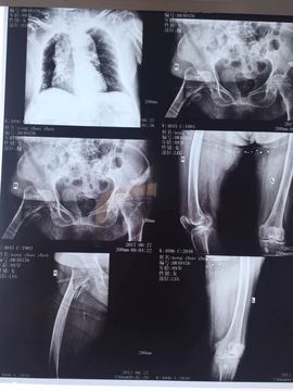 蒙多～主播照片