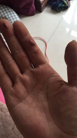 涛有点突出休主播照片