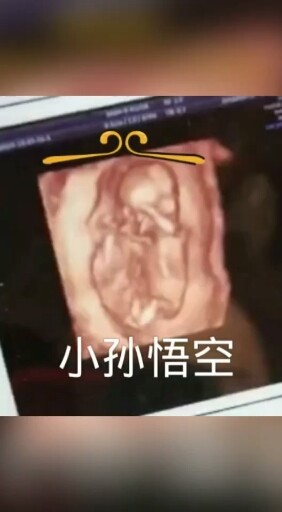 媳妇辛苦了让我们期待小耀阳到来