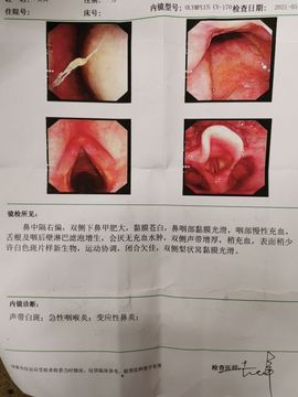 超娃户外鸡鸣三省峡谷主播照片