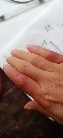 小芳，🌸减肥打卡主播照片