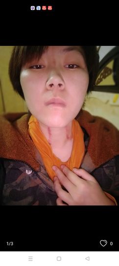 揪眉心爱唱歌的图片