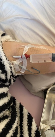 920ゝ酸奶抗癌中主播照片