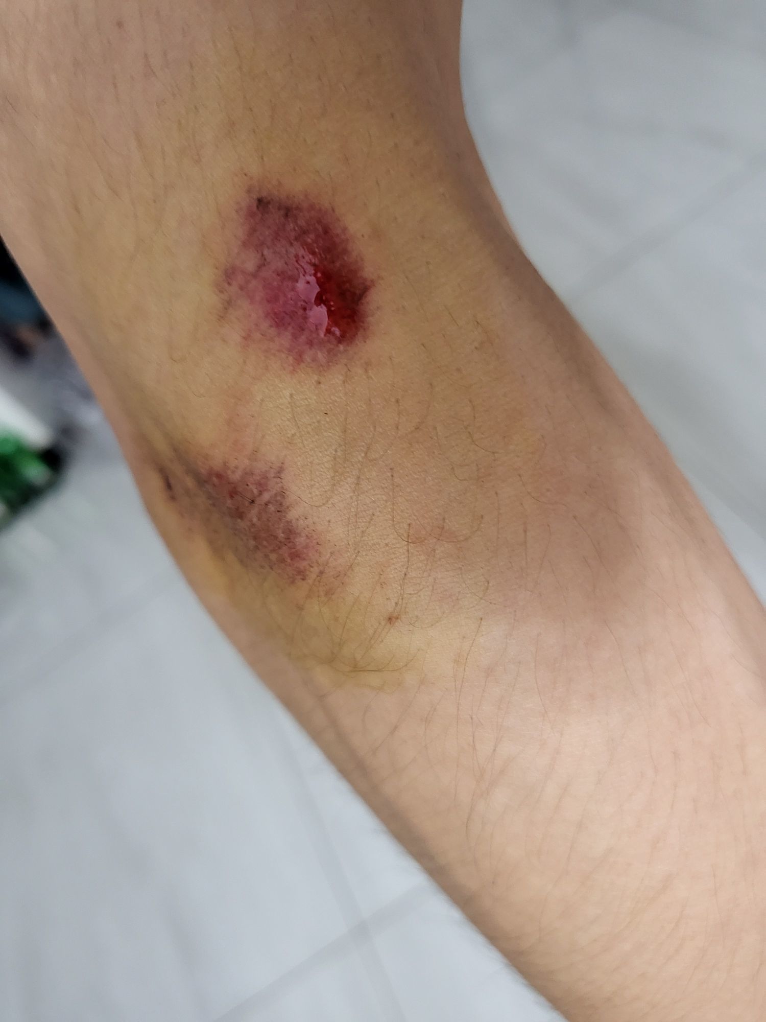 小童5178🤴主播图片