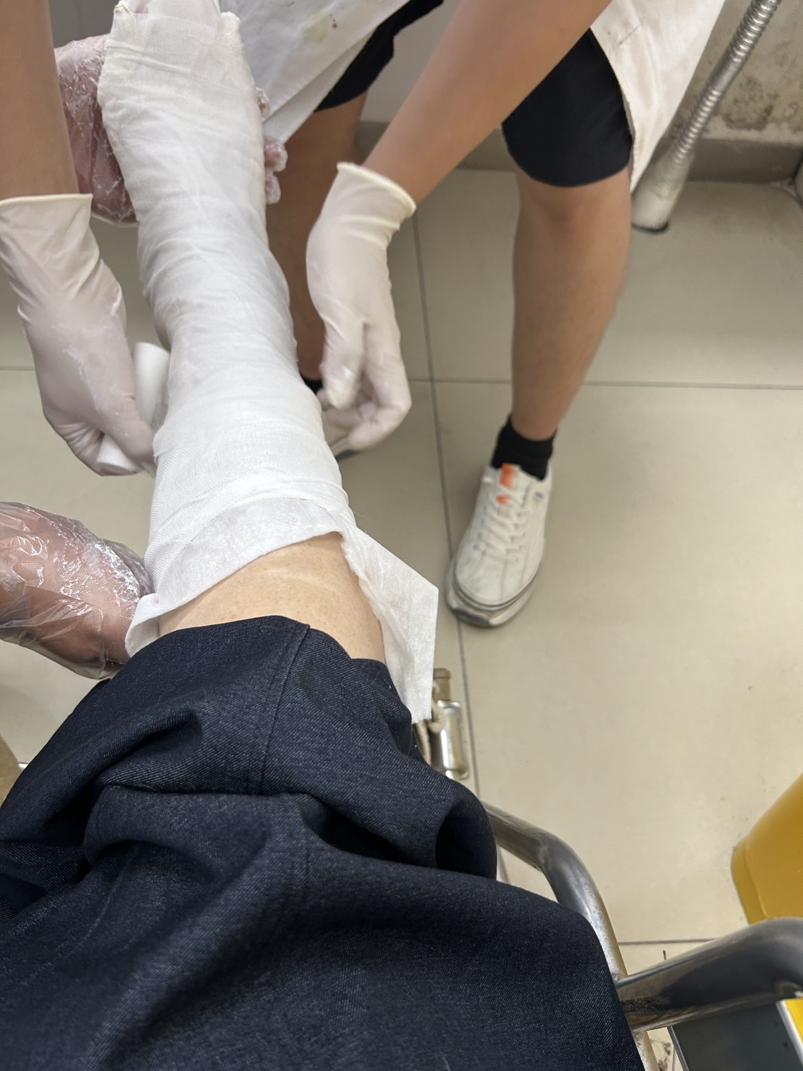 脆皮果果脚骨折了病休主播图片