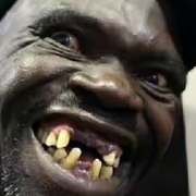 黑人澳得标捡豆镶金牙