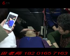 王红锦徒手整形颧骨、额骨的调整