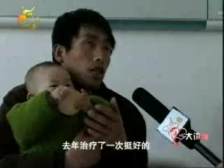 郑州哪家医院治疗鲜红斑痣最好呢？郑州长峰医院