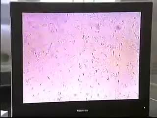 新手养牛-肉牛品种介绍和疾病防治.flv