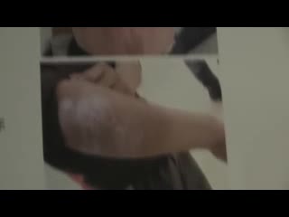 济南治疗银屑病的医院
